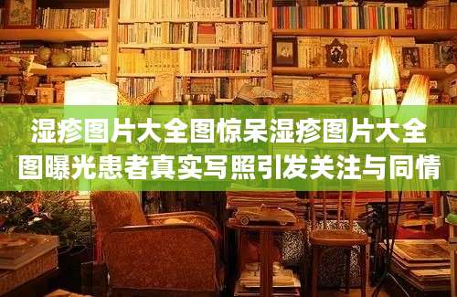 湿疹图片大全图惊呆湿疹图片大全图曝光患者真实写照引发关注与同情
