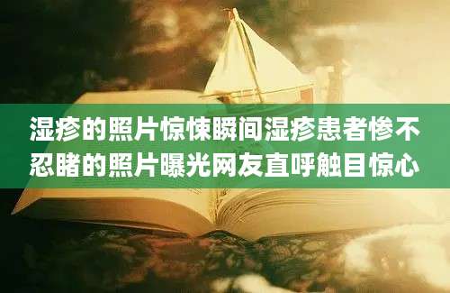 湿疹的照片惊悚瞬间湿疹患者惨不忍睹的照片曝光网友直呼触目惊心